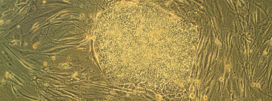 Cell culture with embryonic (human) stem cells